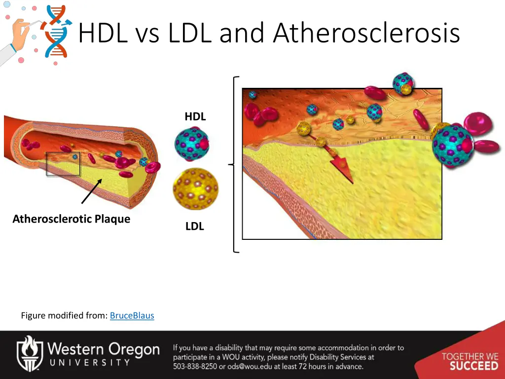 hdl vs ldl and atherosclerosis