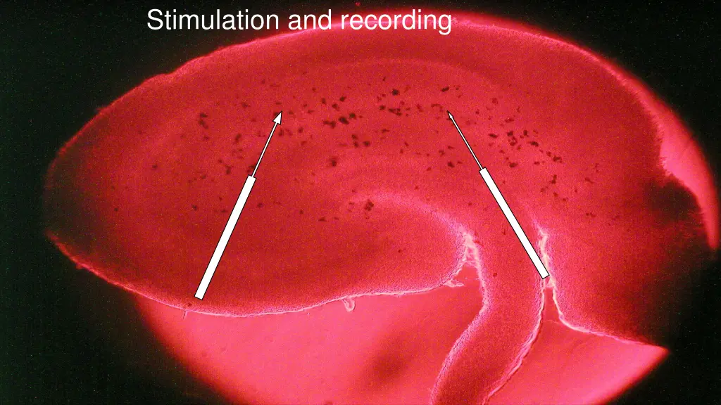 stimulation and recording