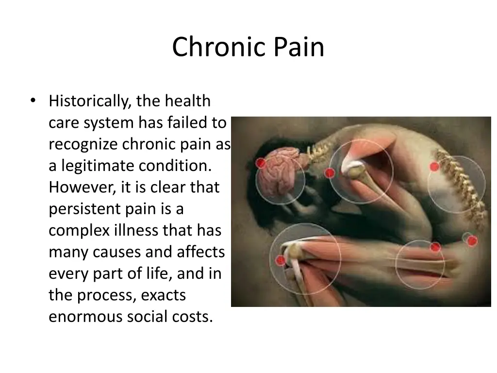 chronic pain 7