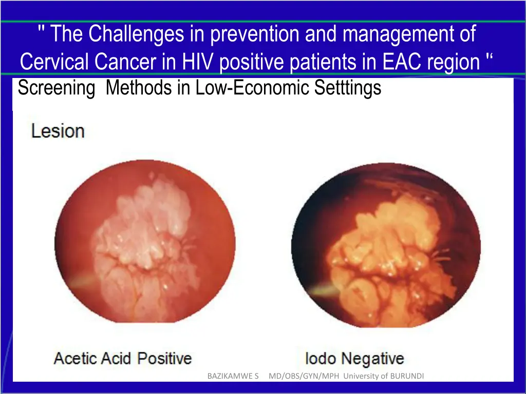 the challenges in prevention and management 17