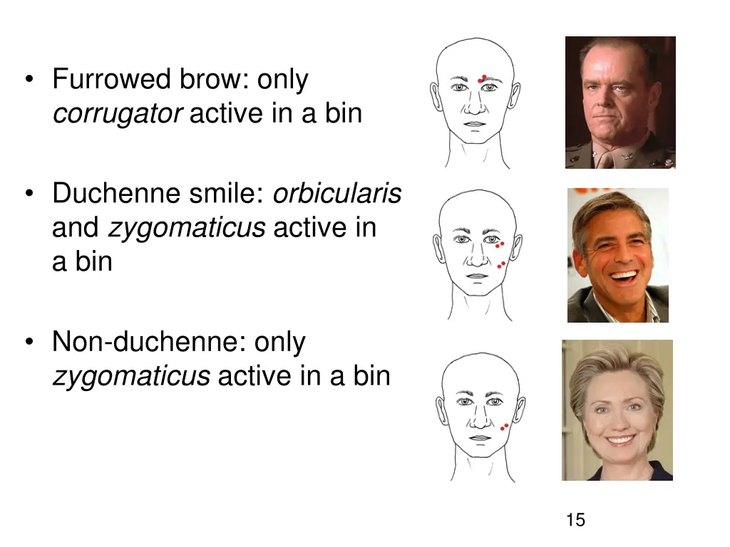 furrowed brow only corrugator active in a bin