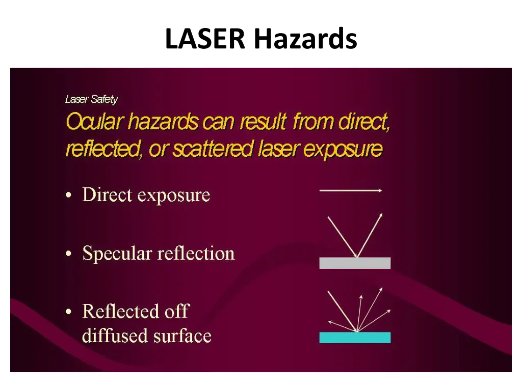 laser hazards
