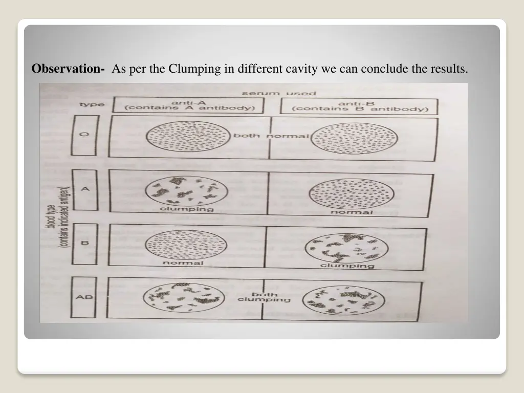 observation as per the clumping in different