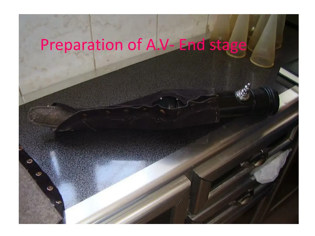 preparation of a v end stage