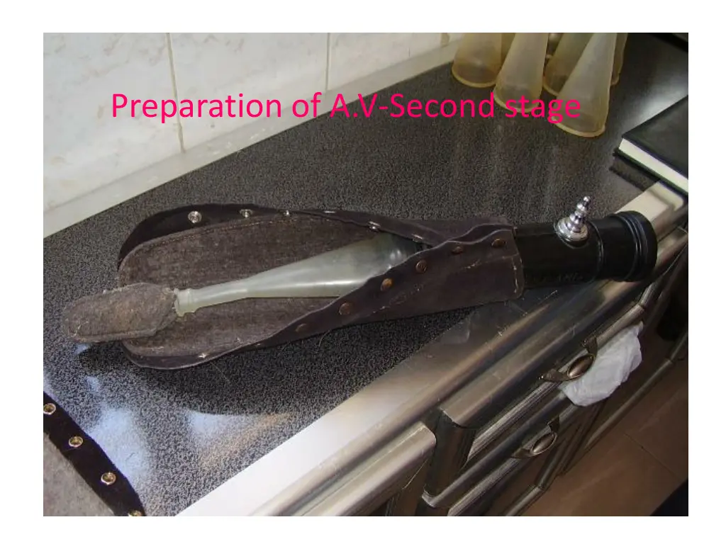 preparation of a v second stage