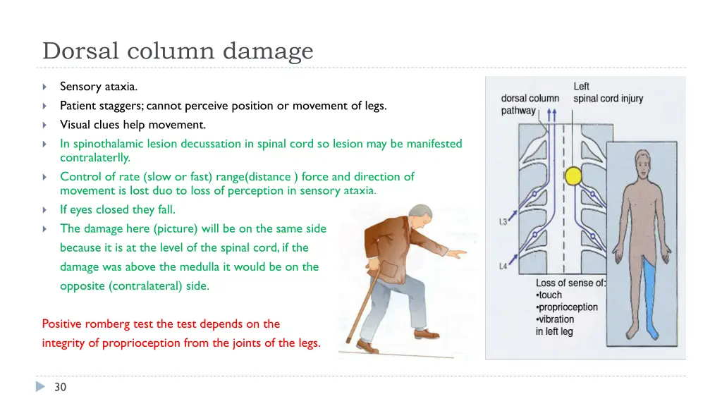 dorsal column damage