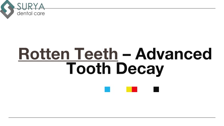 rotten teeth rotten teeth advanced tooth decay