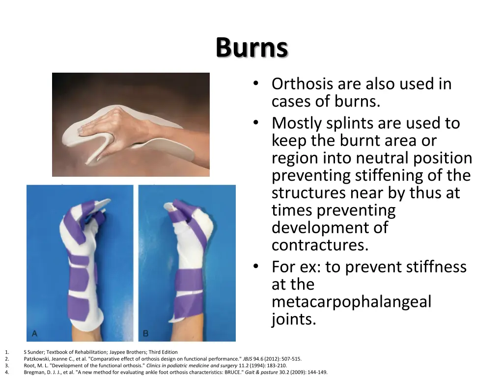 burns orthosis are also used in cases of burns