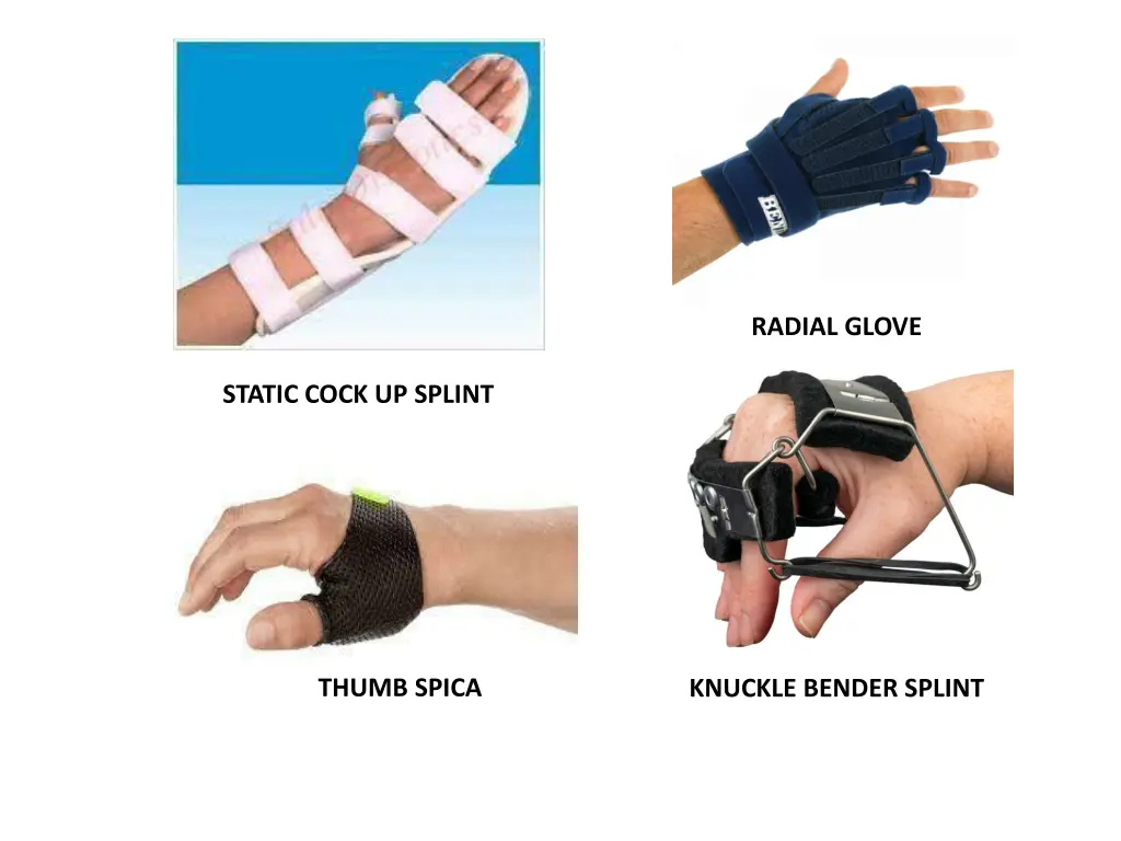 radial glove