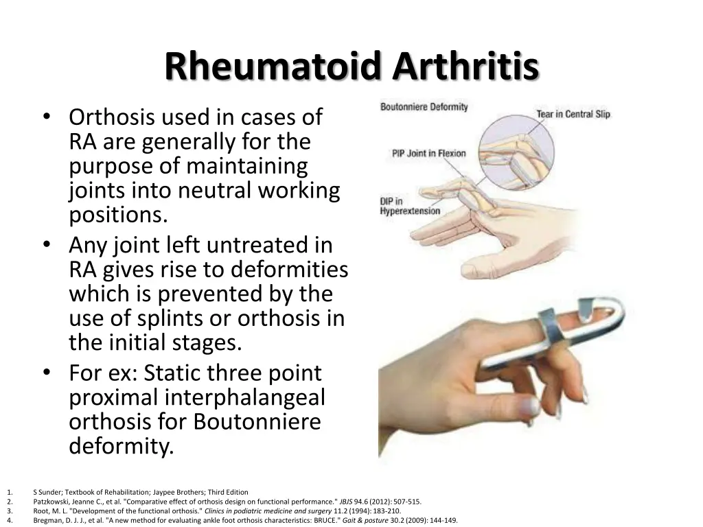 rheumatoid arthritis orthosis used in cases
