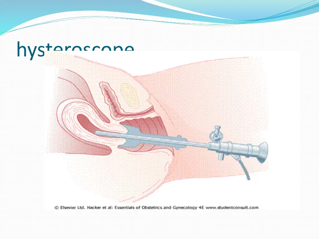 hysteroscope