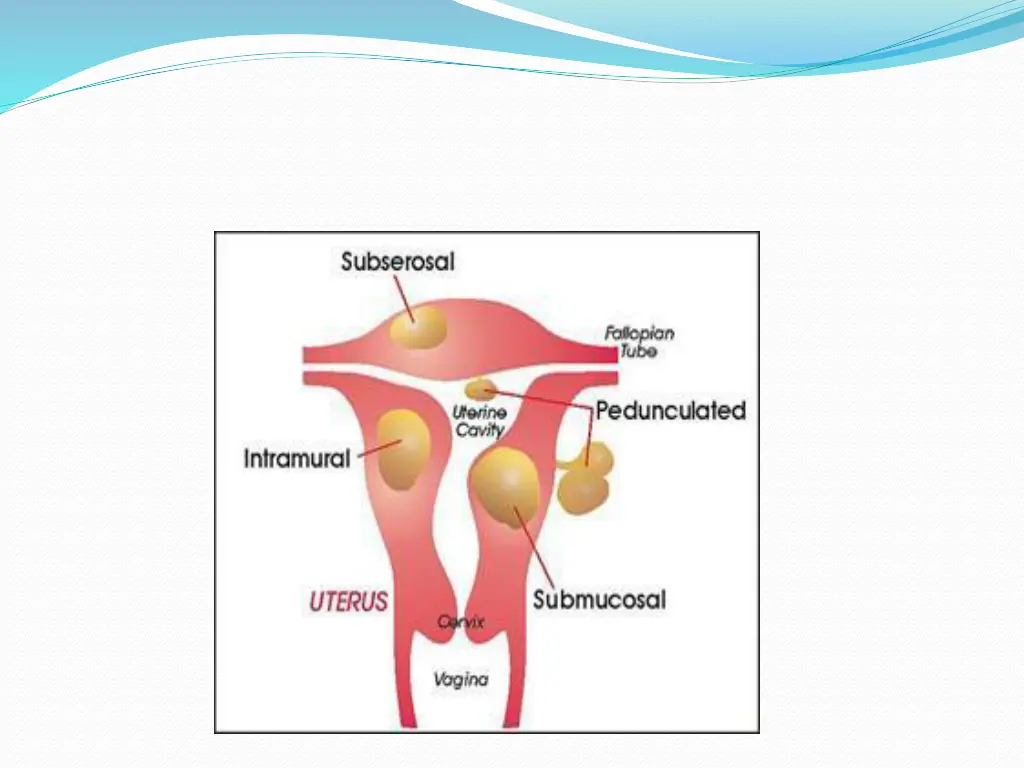 slide24