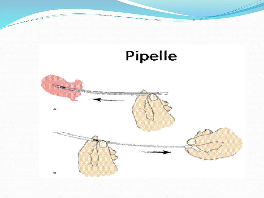 slide34