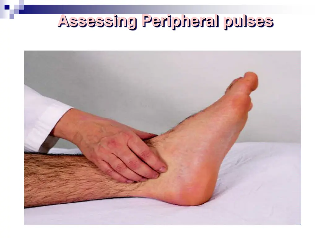 assessing peripheral pulses 1