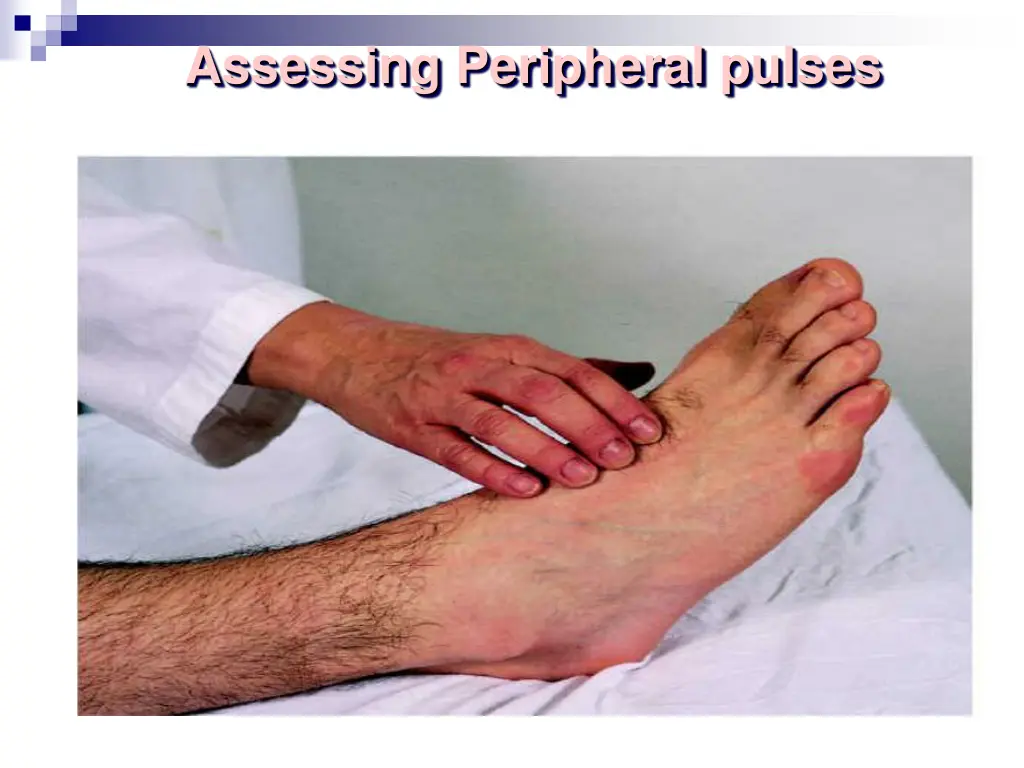 assessing peripheral pulses 2