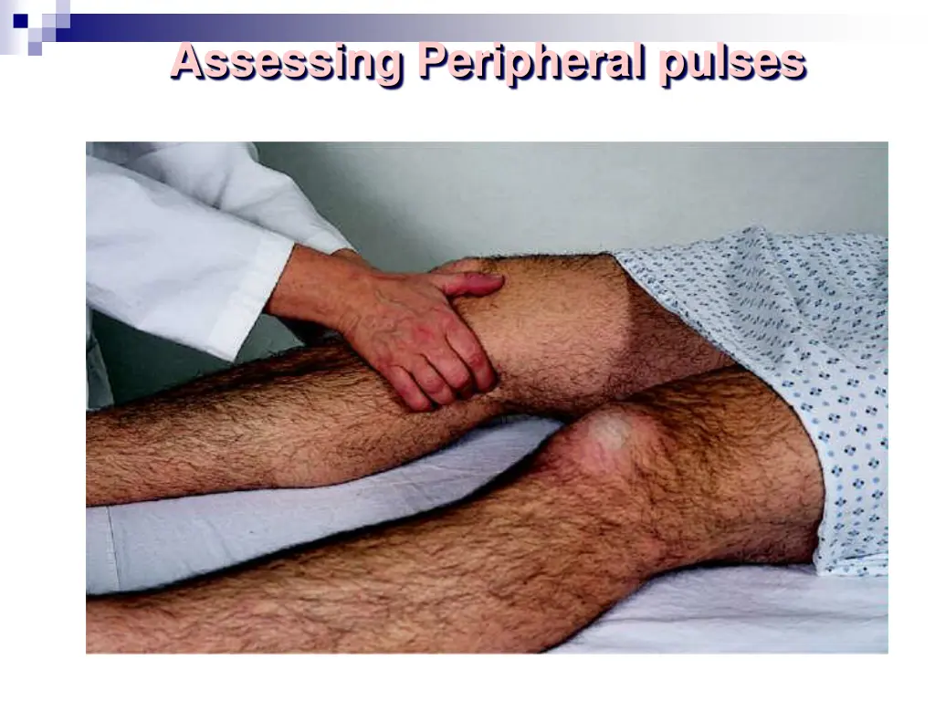 assessing peripheral pulses