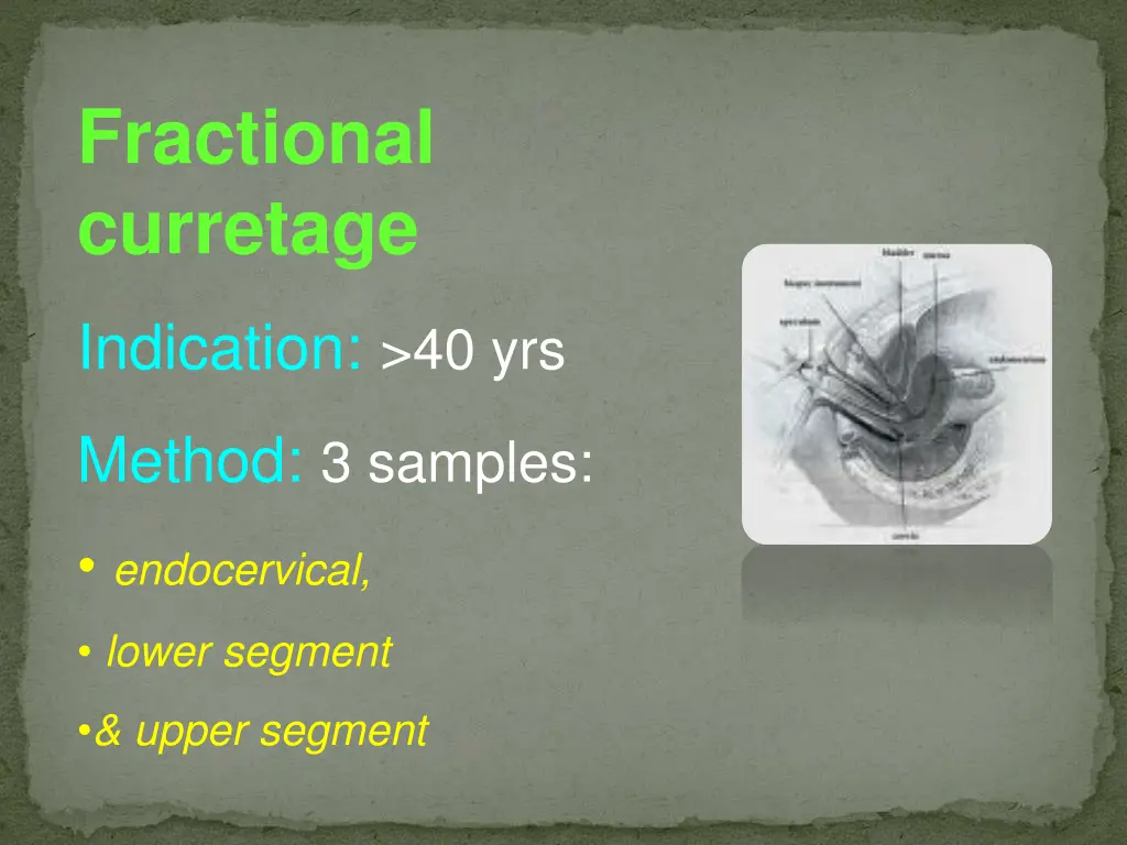 fractional curretage