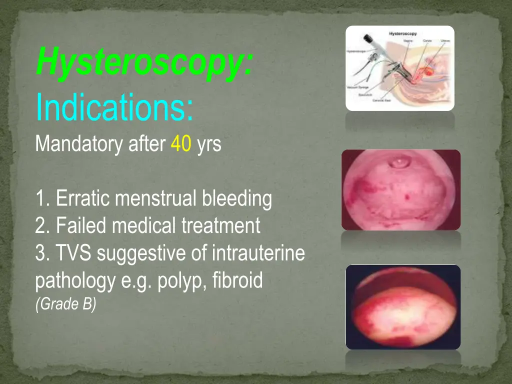 hysteroscopy indications mandatory after 40 yrs