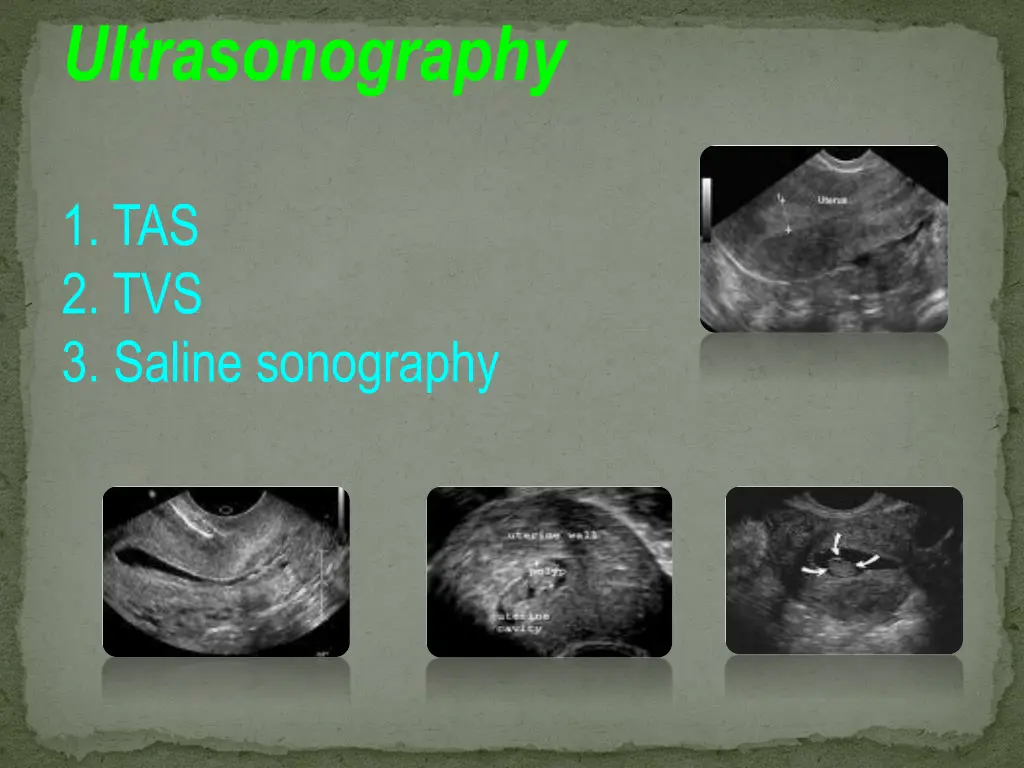 ultrasonography