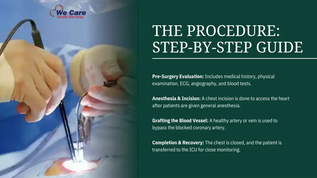 the procedure step by step guide