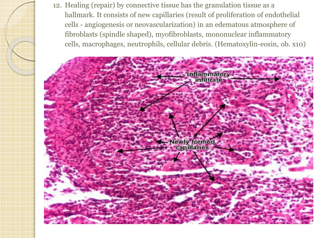 12 healing repair by connective tissue