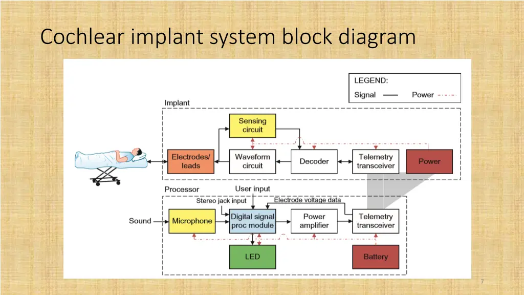 cochlear implant system block diagram