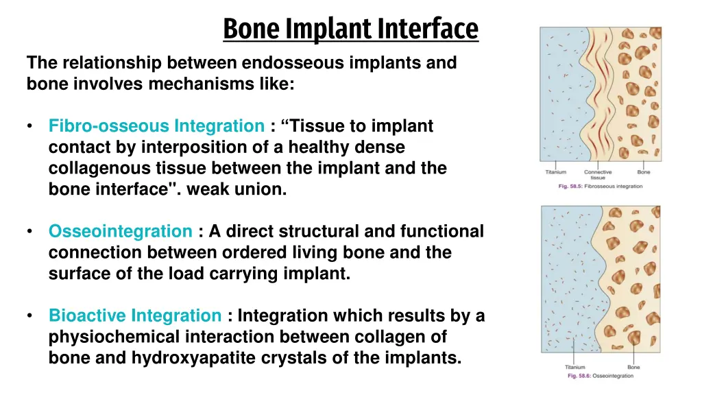 bone implant interface