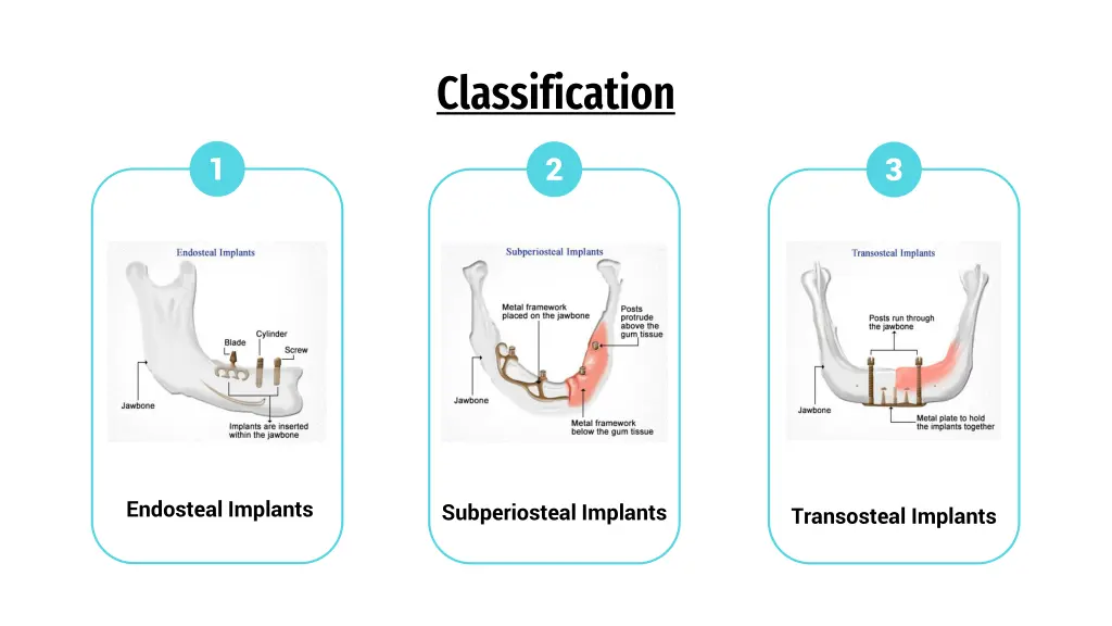 classification