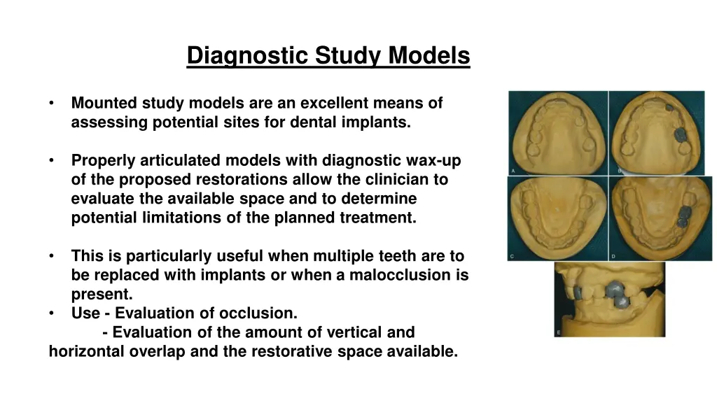 diagnostic study models