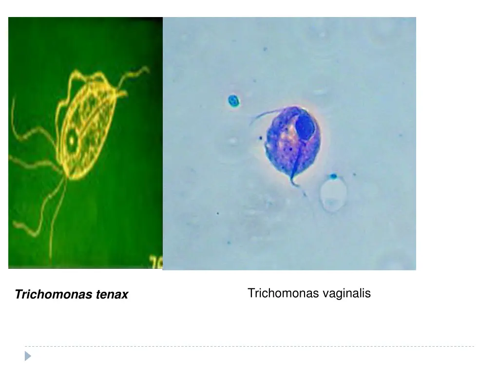 trichomonas vaginalis