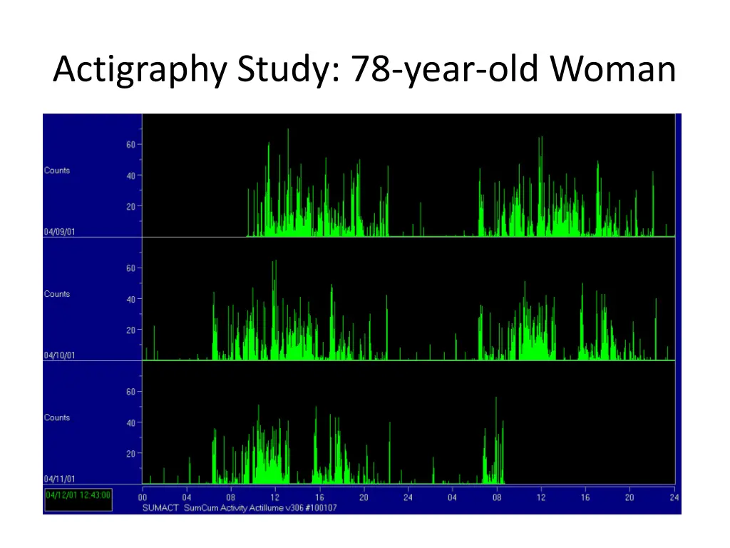 actigraphy study 78 year old woman