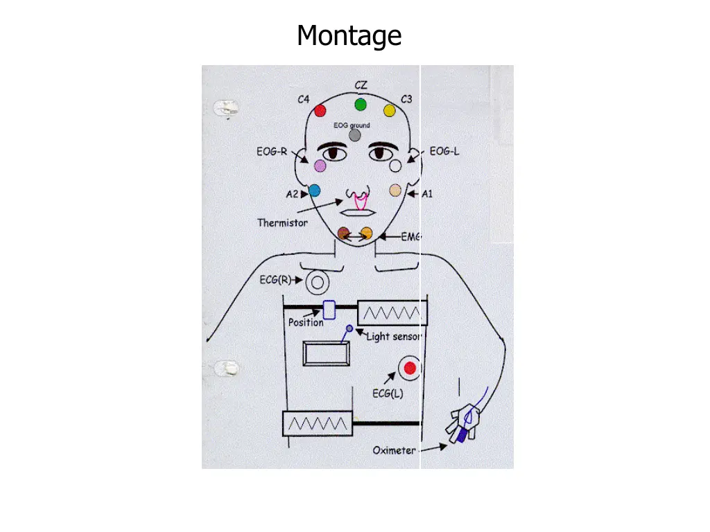 montage