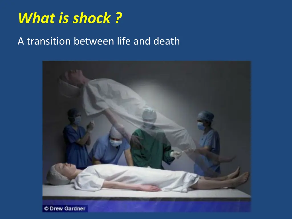 what is shock 1