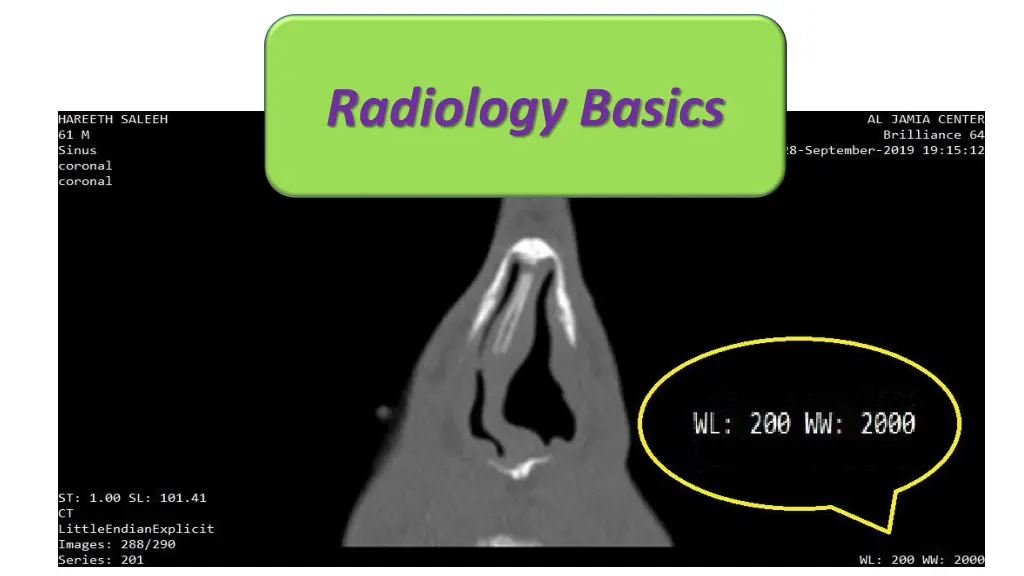 radiology basics