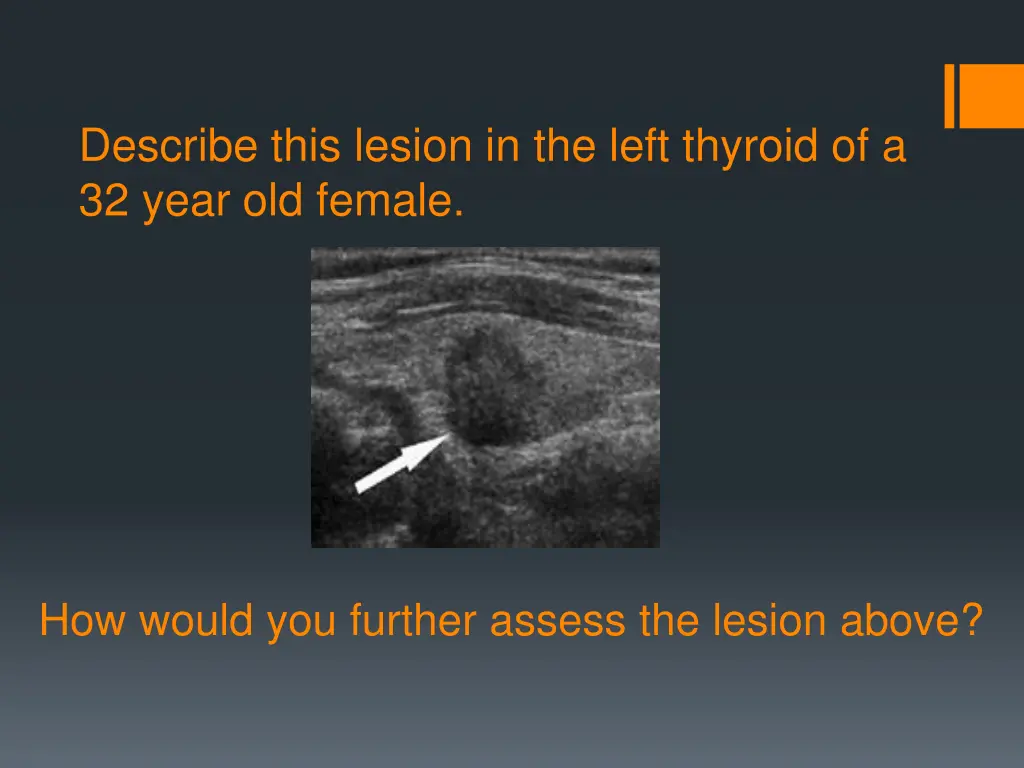 describe this lesion in the left thyroid