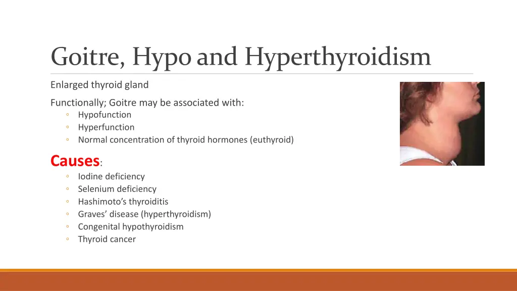 goitre hypo and hyperthyroidism
