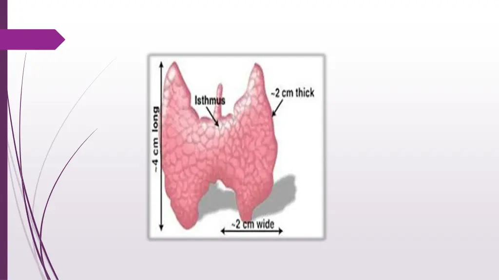 slide3
