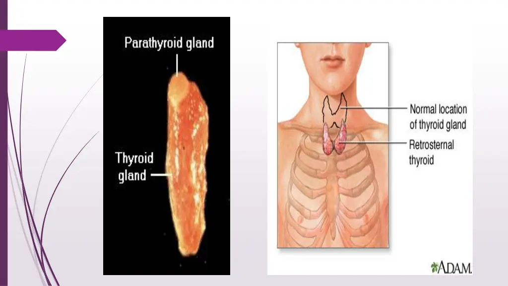 slide9