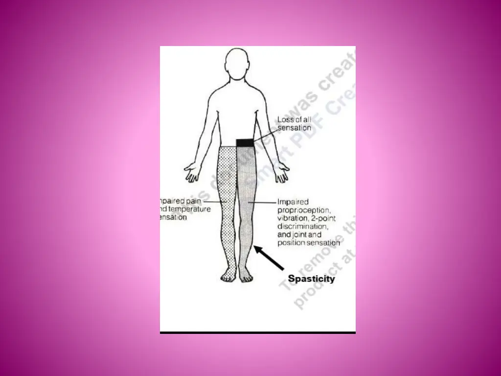 slide22