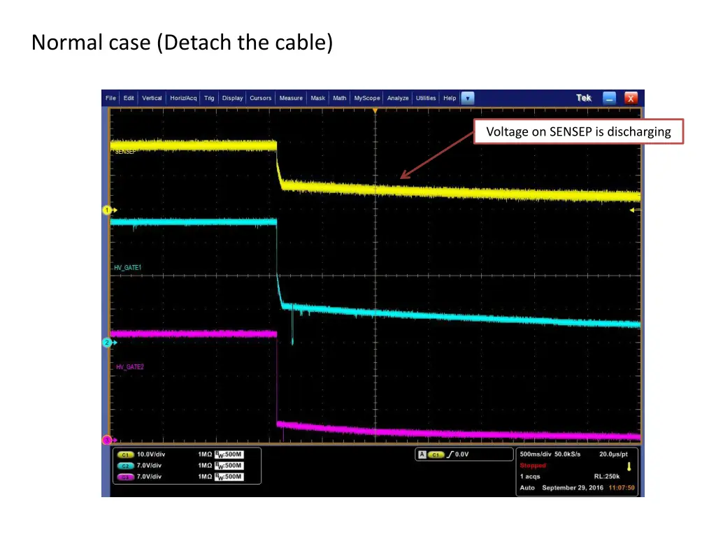 normal case detach the cable