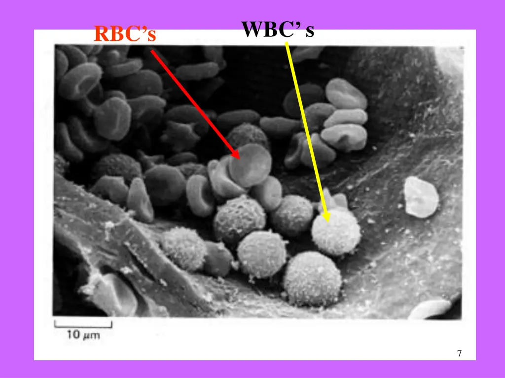 wbc s