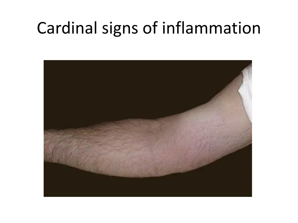 cardinal signs of inflammation 1