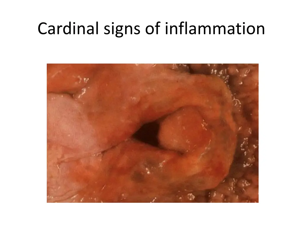 cardinal signs of inflammation 3