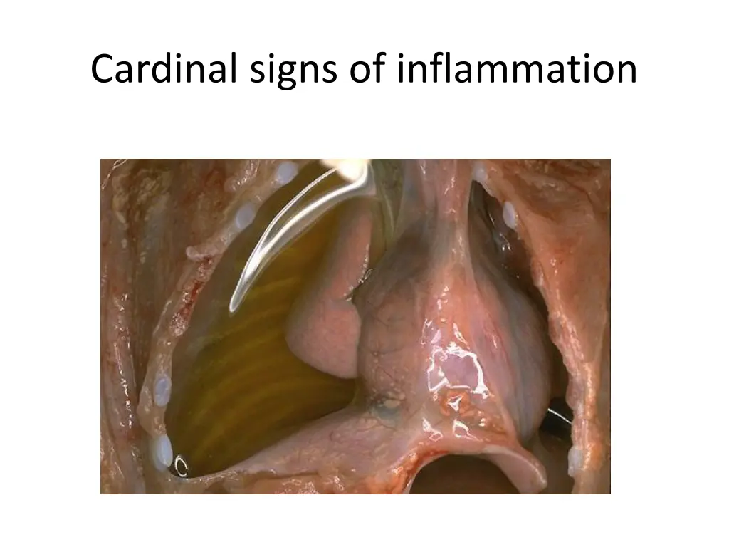 cardinal signs of inflammation 4
