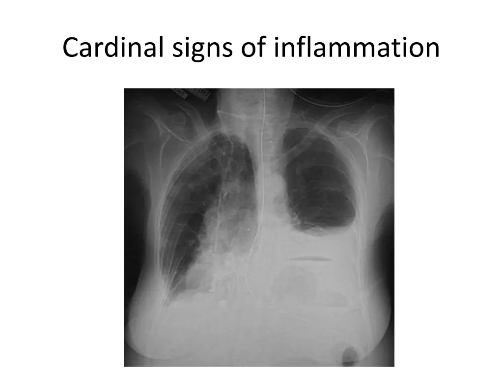 cardinal signs of inflammation 5