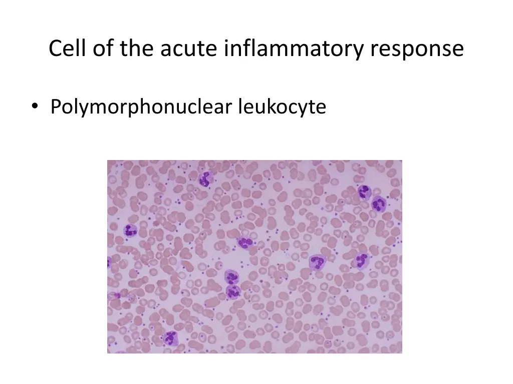cell of the acute inflammatory response