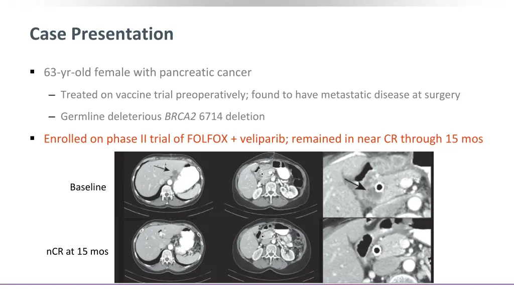 case presentation 2