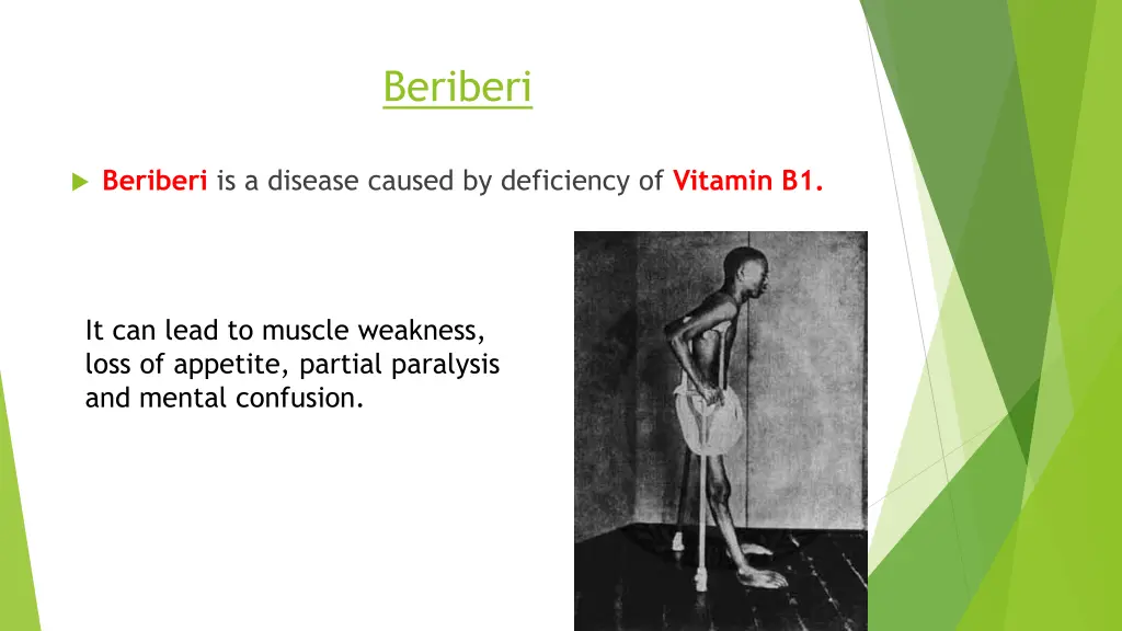 beriberi