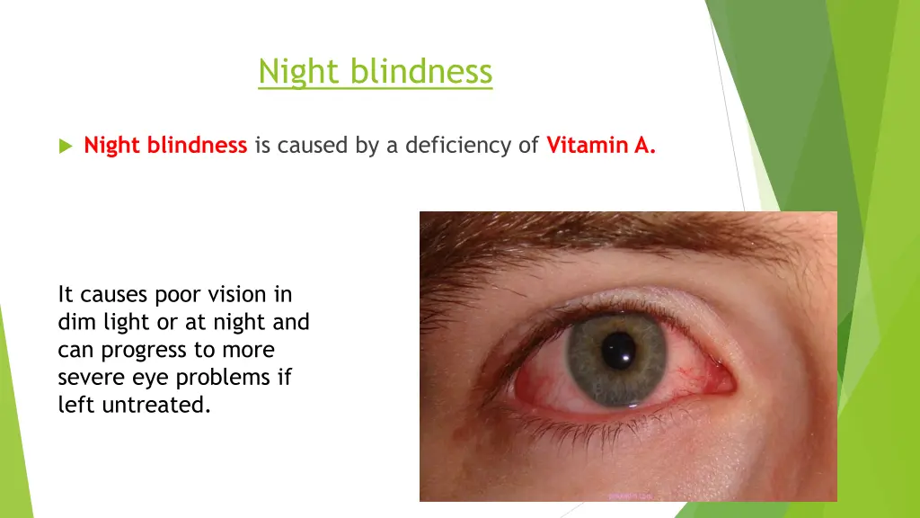 night blindness
