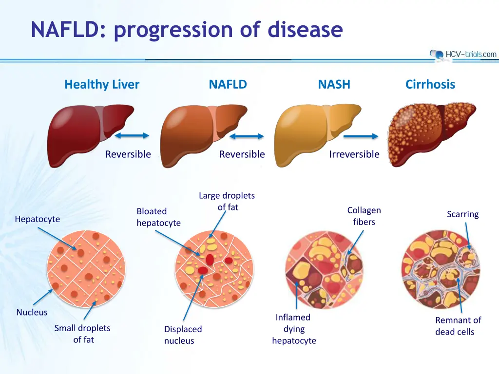 nafld progression of disease